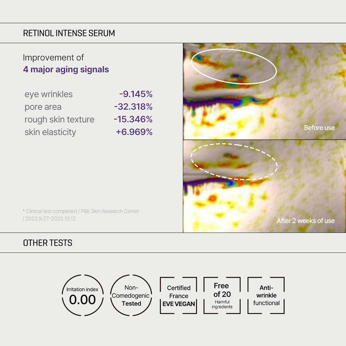 SOME BY MI Retinol Intense Trial Kit 0.33Oz, 10Ml